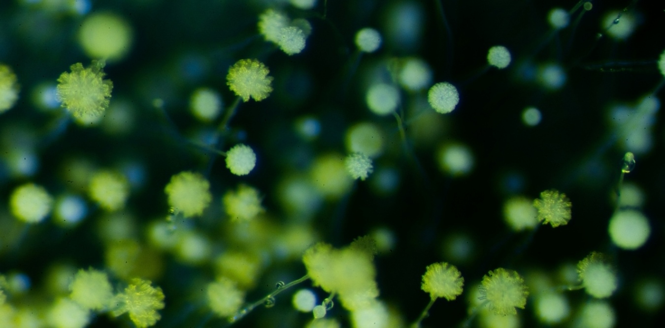 麹菌(光学顕微鏡)/画像:独立法人 酒類総合研究所